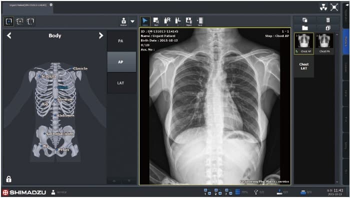 Painel DR Wireless VIVIX-S Série V — Detector flat panel wireless — foto 4
