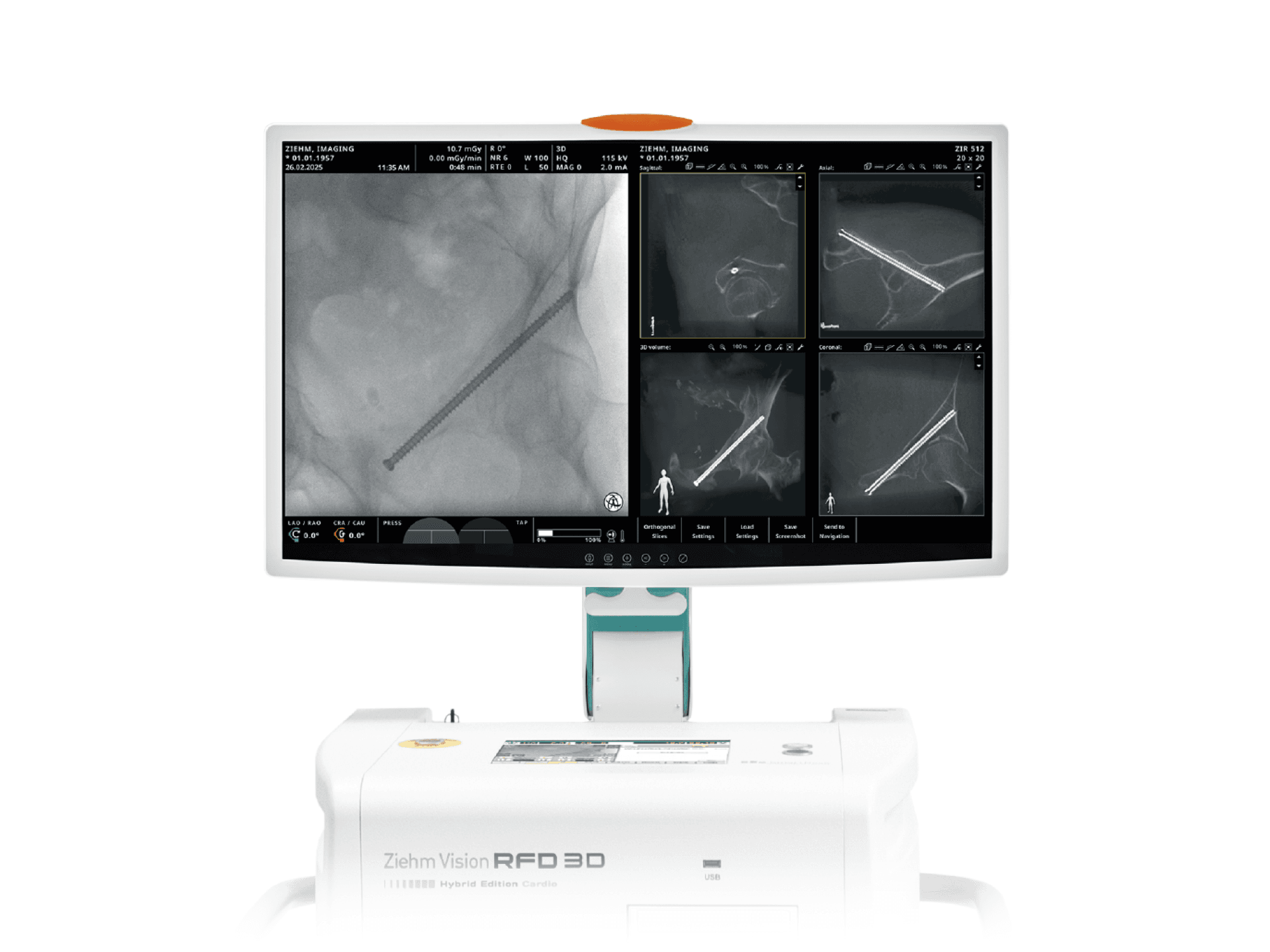 Ziehm Vision RFD 3D — Arco cirúrgico (C-arm) — foto 4