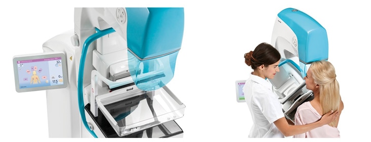 Mamógrafo digital Planmed Clarity 3D (Shimadzu) com técnica posicionando paciente para exame de mamografia com tomossíntese